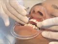 Aparelho Odontologico