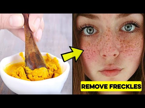 video-linktoworks-How to Get Rid of Freckles on Your Face at Home | 3 Home ...