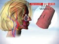UK To Follow Face Transplant Success UK To Follow Face Transplant Success
