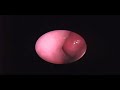 Nasal Endoscopy