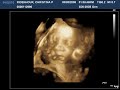 baby ridenhour
