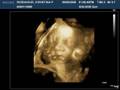 baby ridenhour