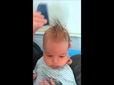 how to remove cradle cap