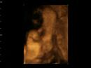 aaron-dandrea-2.html