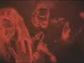 Beheaded (malta) - Disdain