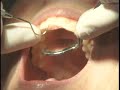 FLUORIDE & BOTTLED WATER Pf.wmv
