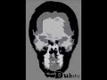 FL Studio Dubstep - \"Cocaine\"