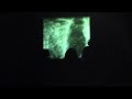 fear falls burning live at Occii, Amsterdam fear falls burning live at Occii, Amsterdam
