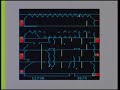 Downland for TRS-80 Dr. Seuss Level