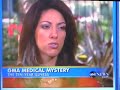Lyme Disease