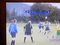 (Metatarsal) KeithoGs Games