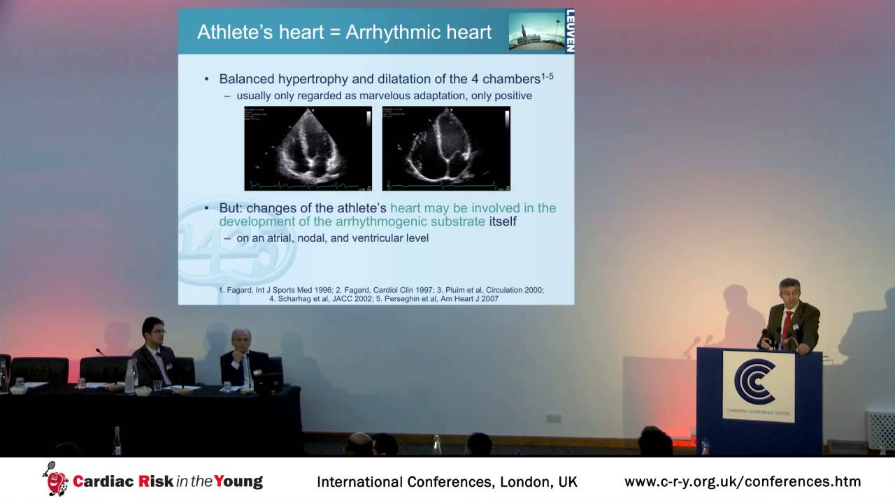 Arrhythmias in Athletic Individuals: Innocent Bystanders or Markers of Athletic Heart Disease