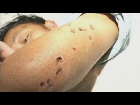 0 photo 0 Hornet Attacks Kill Dozens in China picture