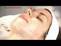 SISTEMA DE RENOVACION CUTANEA EFECTO PEELING SISTEMA DE RENOVACION CUTANEA EFECTO PEELING