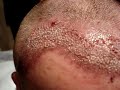 Dr Bisanga - BHR Clinic