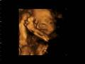 Joyan's baby video clip1