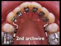 Dentista - Ortodontia Lingual
