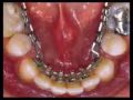 Dentista - Ortodontia Lingual