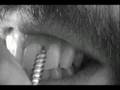 Entry #86 - An Adam Kontras Film