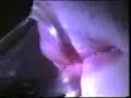 Horn player vibrating lips slow motion - awesome Horn player vibrating lips slow motion - awesome