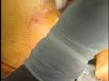 orthopaedic surgery
