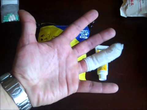 how to stop knife cut finger bleed