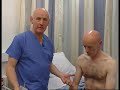 MRCP PACES Motor System Arms