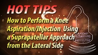 Mastering Lateral Suprapatellar Knee Injections