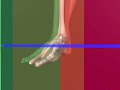 Cardinal Planes Functional Orthopedics - 01 - Podiatry