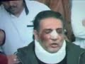 fabian lavalle con el rostro golpeado