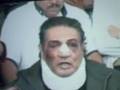 Fabian Lavalle con el Rostro Golpeado