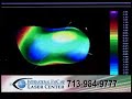 International Eye Care