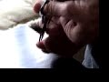 Removing Stiches
