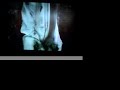Ekem + Scorp�ne + Nibool