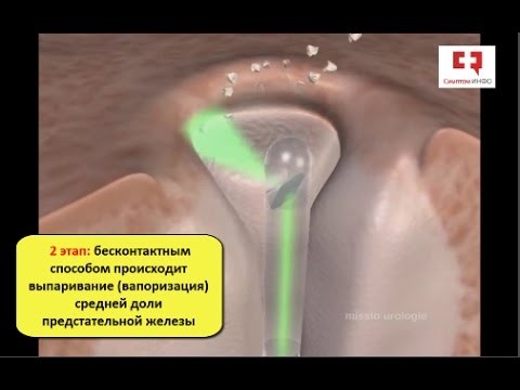 Витапрост отзывы цена