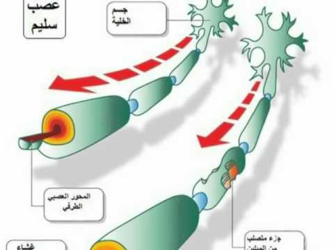 how to be tested for ms