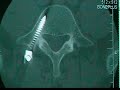 Bone+