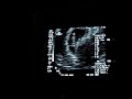 Our 2nd Ultrasound 7 wks 4 ds :D