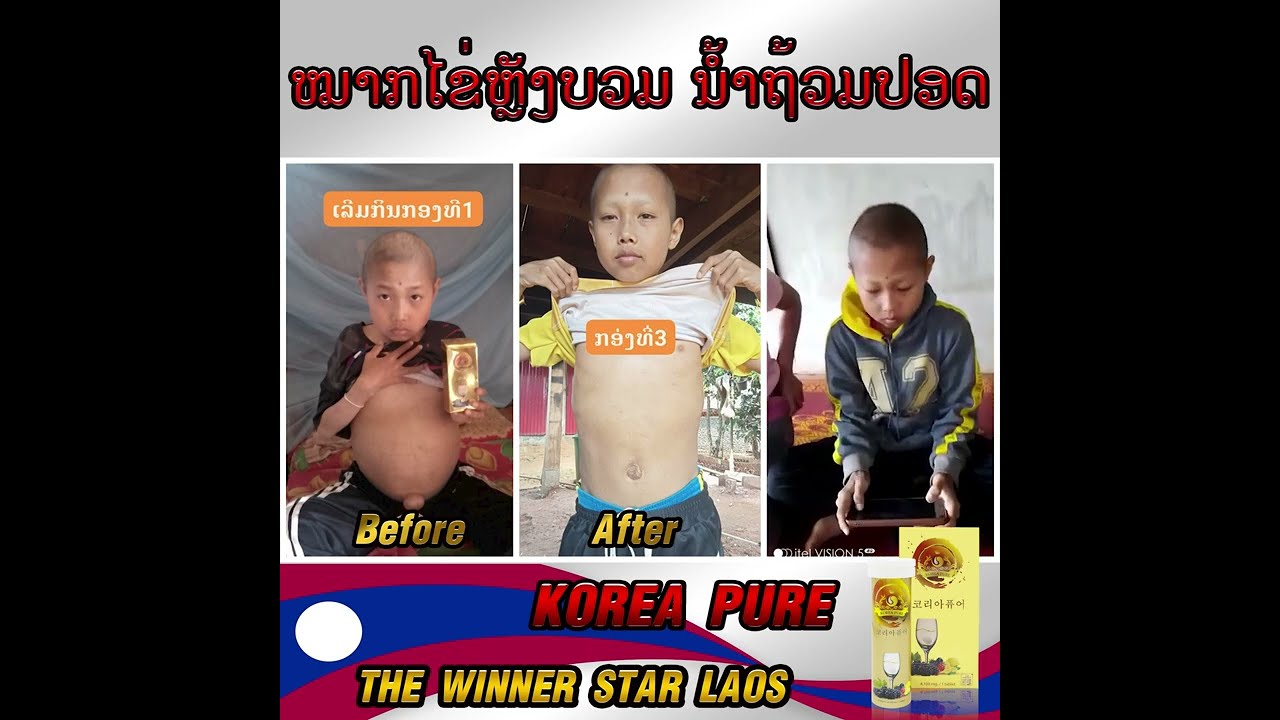 Korea Pure Review By ท้าว น้อย เมืองปากช่อง แขวง จำปาสัก