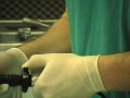 Intubazione con fibroscopio di Bonfils Intubazione con fibroscopio di Bonfils