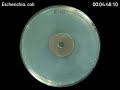 Escherichia. coli - Zonex