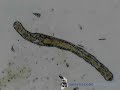 Aelosoma hemprichi (240x)