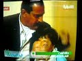 Congenital anomaly