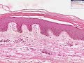 Shotgun Histology Thin Skin