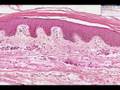 Shotgun Histology Thin Skin