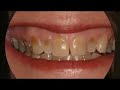 Cosmetic Dentistry  in San Fernando Valley California