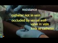 Ultrasound and vein punction