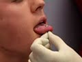 Kyles Tounge Piercing