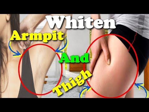 how to whiten armpits fast