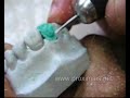Como fabricar uma broca para cera em protese